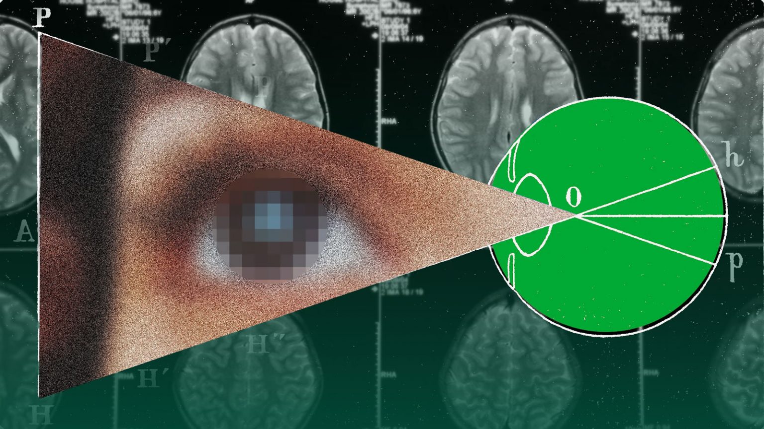 Фото: Імплант Neuralink Blindsight зможе відновити зір, навіть якщо людина втратила зоровий нерв